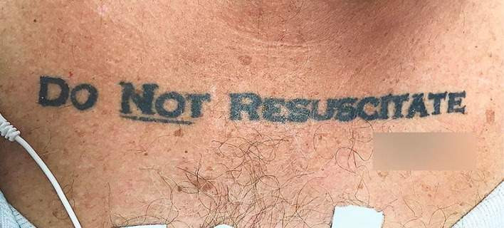 Ασθενής με τατουάζ «Μη ανάνηψης» προκαλεί πανικό σε γιατρούς νοσοκομείου (εικόνα)